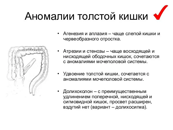 Аномалии толстой кишки Агенезия и аплазия – чаще слепой кишки и