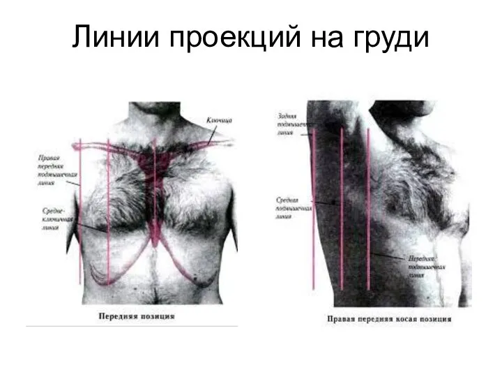 Линии проекций на груди