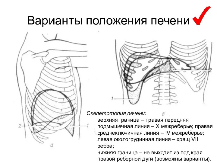 Варианты положения печени Скелетотопия печени: верхняя граница – правая передняя подмышечная