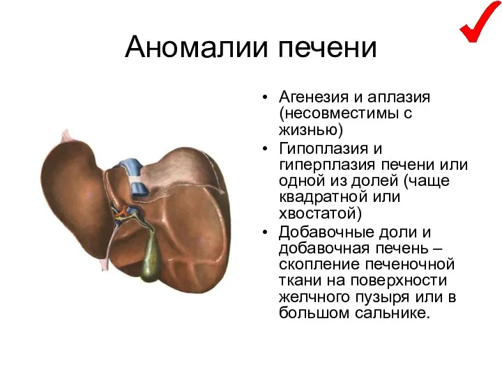 Аномалии печени Агенезия и аплазия (несовместимы с жизнью) Гипоплазия и гиперплазия