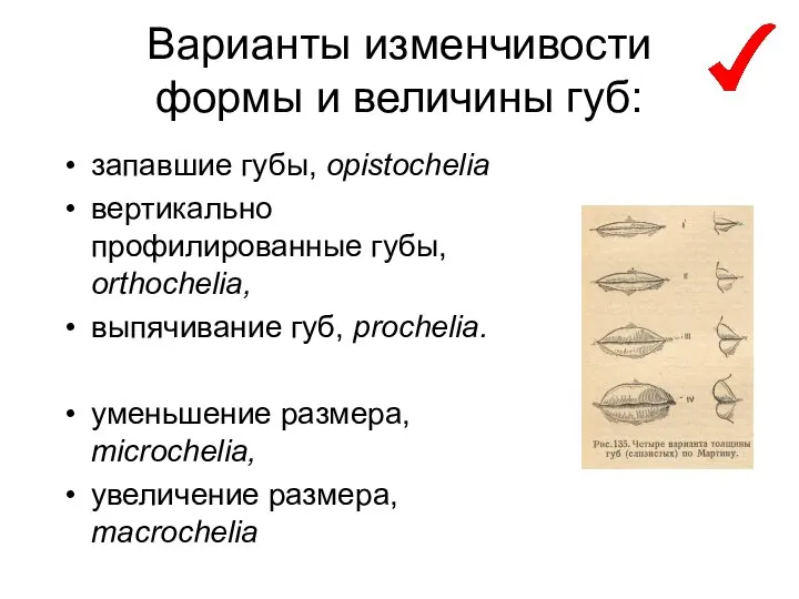 Варианты изменчивости формы и величины губ: запавшие губы, opistochelia вертикально профилированные