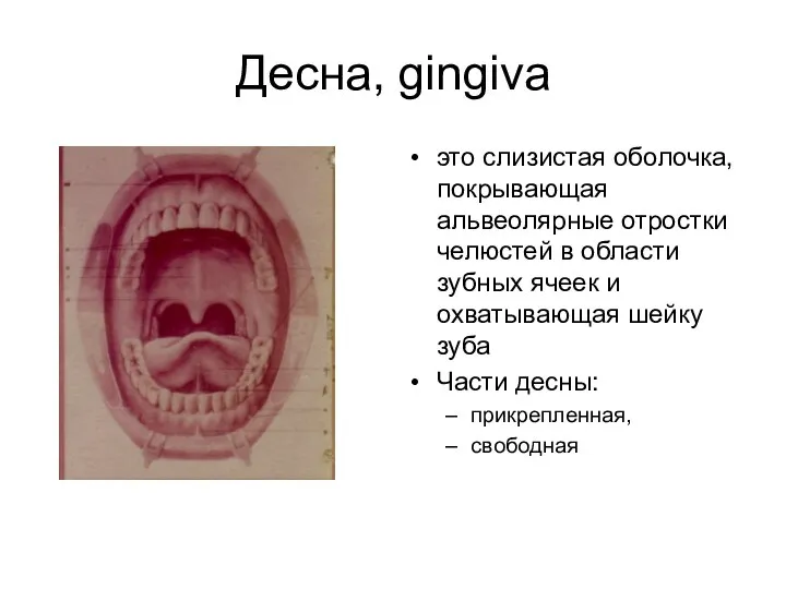 Десна, gingiva это слизистая оболочка, покрывающая альвеолярные отростки челюстей в области