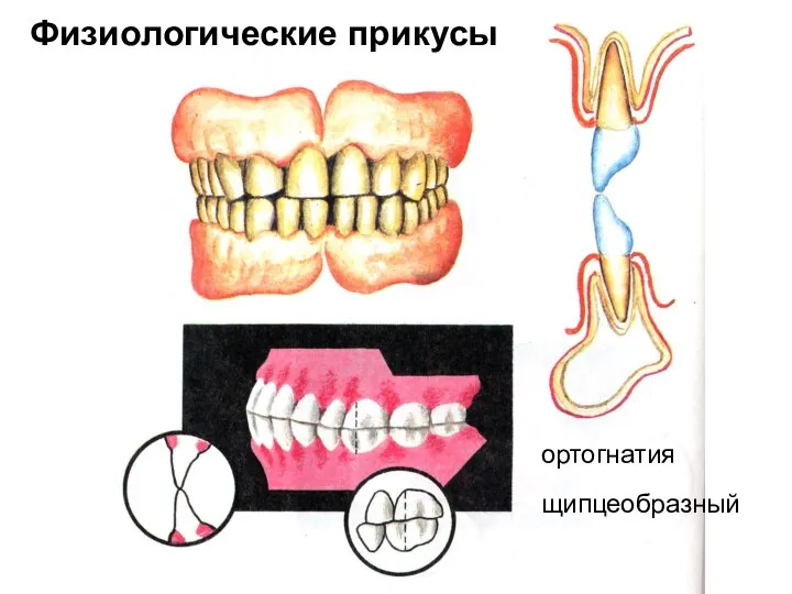 ортогнатия щипцеобразный Физиологические прикусы