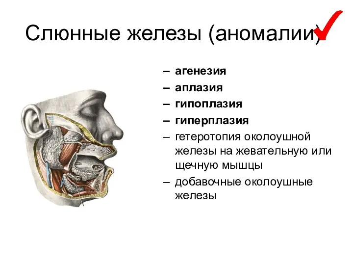 Слюнные железы (аномалии): агенезия аплазия гипоплазия гиперплазия гетеротопия околоушной железы на