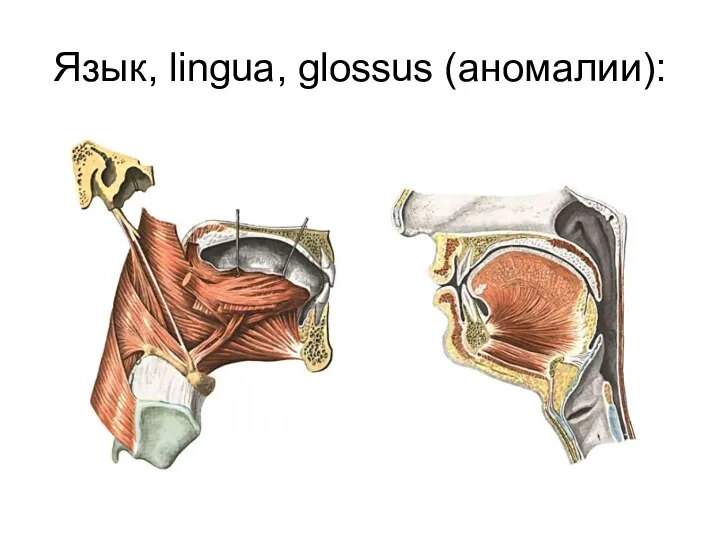 Язык, lingua, glossus (аномалии):