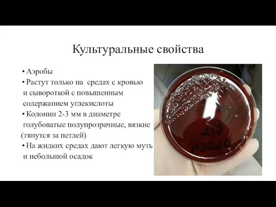 Культуральные свойства Аэробы Растут только на средах с кровью и сывороткой