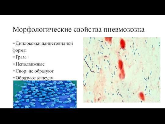 Морфологические свойства пневмококка Диплококки ланцетовидной формы Грам + Неподвижные Спор не образуют Образуют капсулу