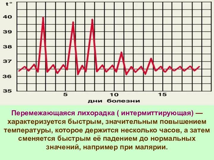 Перемежающаяся лихорадка ( интермиттирующая) — характеризуется быстрым, значительным повышением температуры, которое