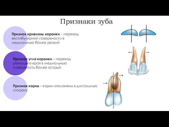 Признаки зуба Признак корня – корни отклонены в дистальную сторону Признак