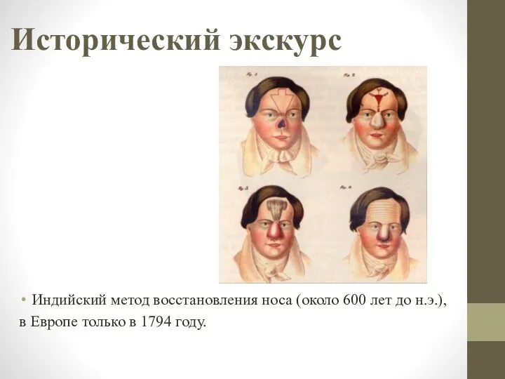 Исторический экскурс Индийский метод восстановления носа (около 600 лет до н.э.),