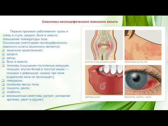 Первые признаки заболевания: кровь и слизь в стуле, диарея, боли в