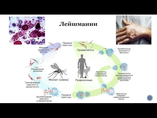 Лейшмании