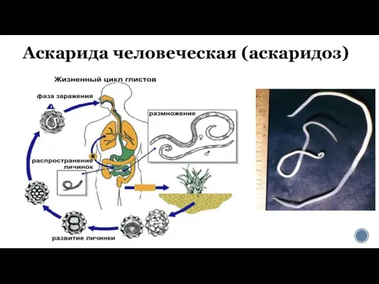 Аскарида человеческая (аскаридоз)