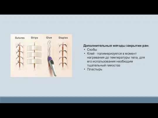 Дополнительные методы закрытия ран: Скобы Клей - полимеризуется в момент нагревания