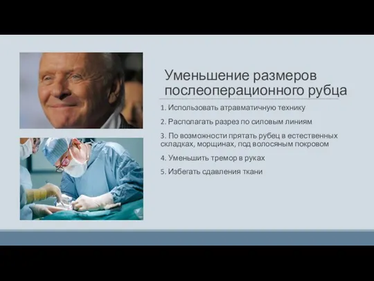 Уменьшение размеров послеоперационного рубца 1. Использовать атравматичную технику 2. Располагать разрез