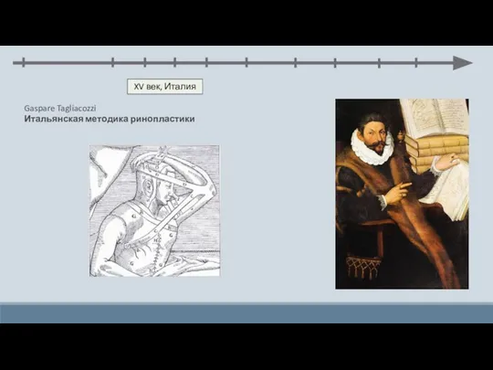XV век, Италия Gaspare Tagliacozzi Итальянская методика ринопластики