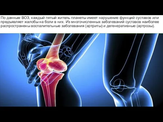 По данным ВОЗ, каждый пятый житель планеты имеет нарушение функций суставов