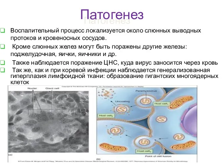 Патогенез Воспалительный процесс локализуется около слюнных выводных протоков и кровеносных сосудов.