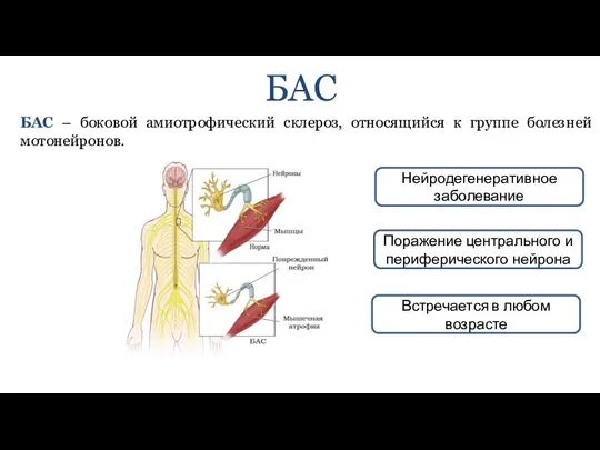 БАС БАС – боковой амиотрофический склероз, относящийся к группе болезней мотонейронов.