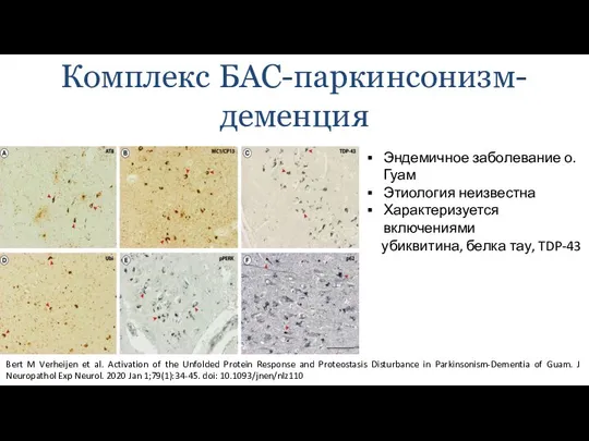 Комплекс БАС-паркинсонизм-деменция Bert M Verheijen et al. Activation of the Unfolded