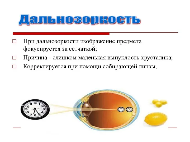 При дальнозоркости изображение предмета фокусируется за сетчаткой; Причина - слишком маленькая