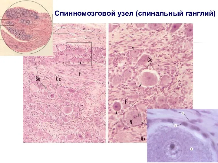 Спинномозговой узел (спинальный ганглий)