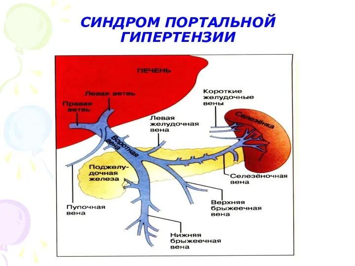 СИНДРОМ ПОРТАЛЬНОЙ ГИПЕРТЕНЗИИ