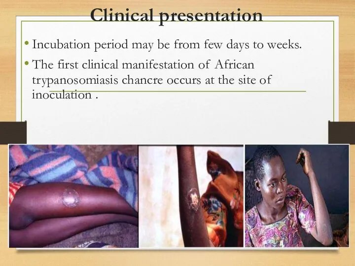 Clinical presentation Incubation period may be from few days to weeks.