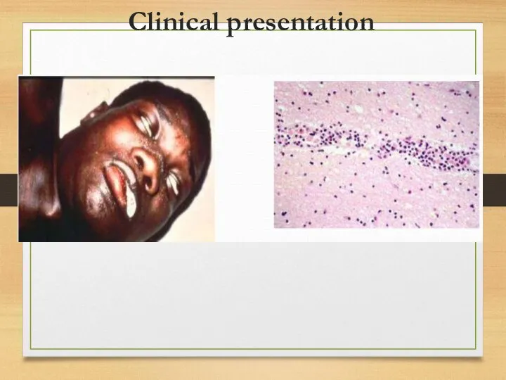 Clinical presentation