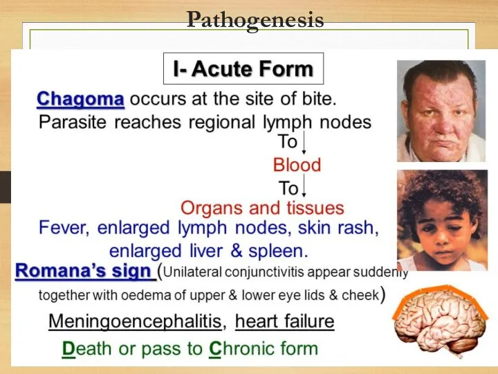 Pathogenesis