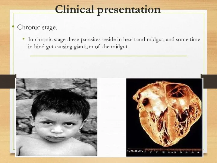 Clinical presentation Chronic stage. In chronic stage these parasites reside in