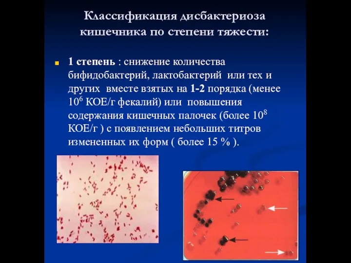 Классификация дисбактериоза кишечника по степени тяжести: 1 степень : снижение количества