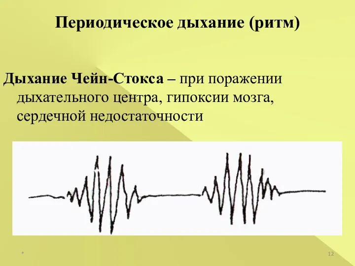 * Периодическое дыхание (ритм) Дыхание Чейн-Стокса – при поражении дыхательного центра, гипоксии мозга, сердечной недостаточности