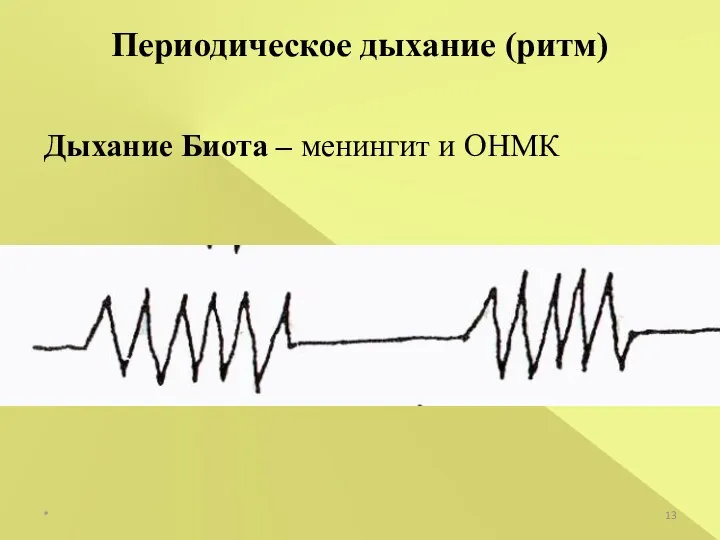 * Периодическое дыхание (ритм) Дыхание Биота – менингит и ОНМК