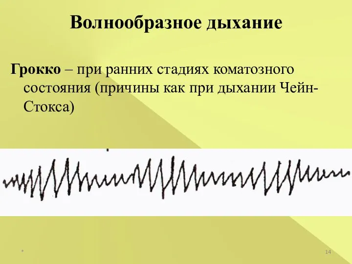 * Волнообразное дыхание Грокко – при ранних стадиях коматозного состояния (причины как при дыхании Чейн-Стокса)