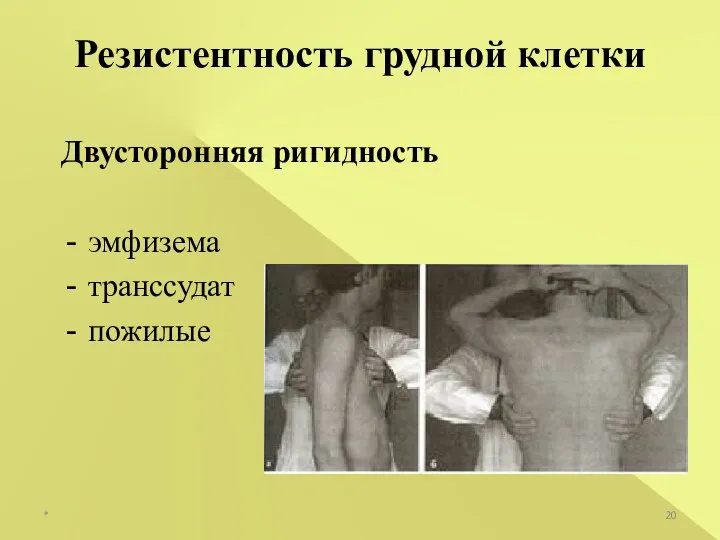 Двусторонняя ригидность эмфизема транссудат пожилые Резистентность грудной клетки *