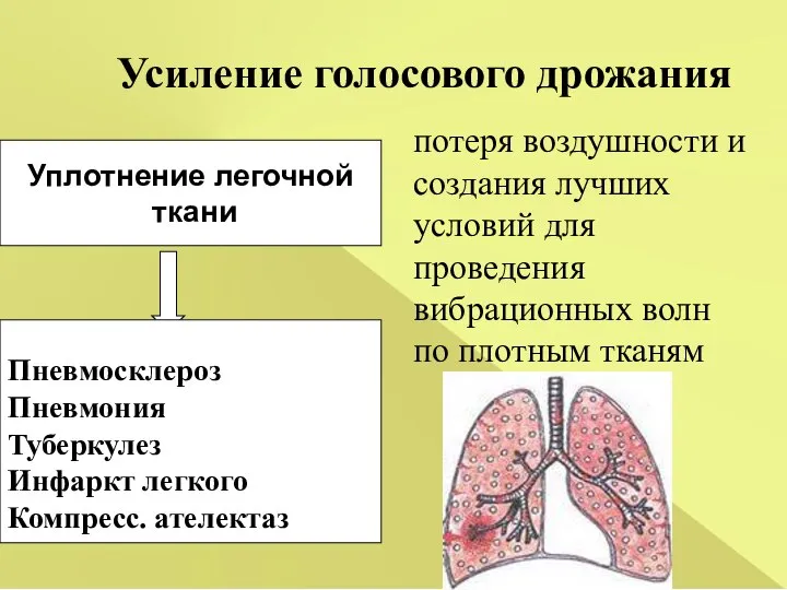 Уплотнение легочной ткани Пневмосклероз Пневмония Туберкулез Инфаркт легкого Компресс. ателектаз Усиление