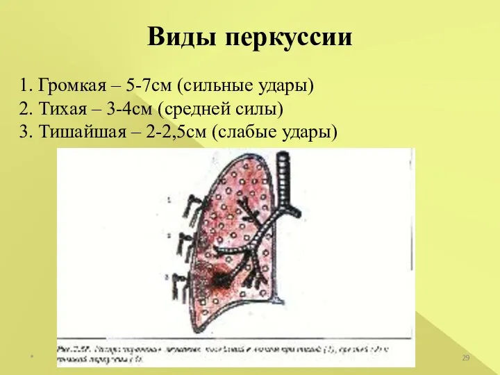 Виды перкуссии 1. Громкая – 5-7см (сильные удары) 2. Тихая –