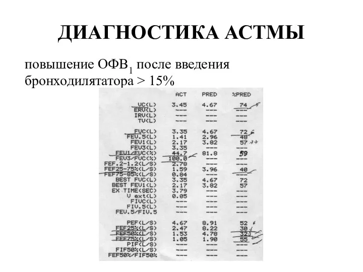 ДИАГНОСТИКА АСТМЫ повышение ОФВ1 после введения бронходилятатора > 15%