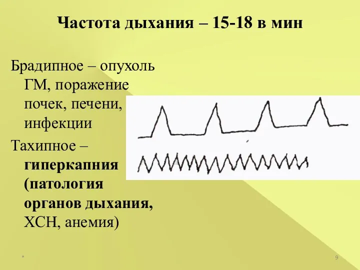 * Частота дыхания – 15-18 в мин Брадипное – опухоль ГМ,