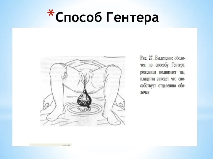 Способ Гентера