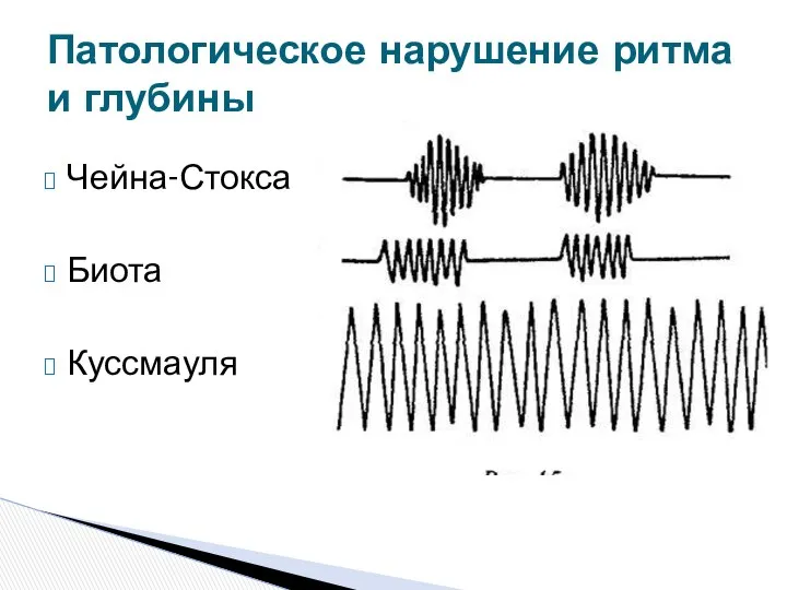 Чейна-Стокса Биота Куссмауля Патологическое нарушение ритма и глубины