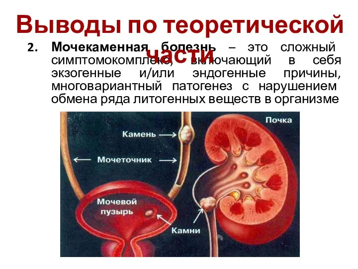 Мочекаменная болезнь – это сложный симптомокомплекс, включающий в себя экзогенные и/или