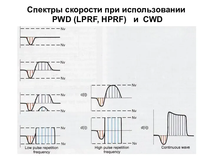 Спектры скорости при использовании PWD (LPRF, HPRF) и CWD