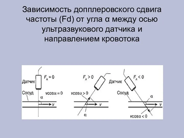 Зависимость допплеровского сдвига частоты (Fd) от угла α между осью ультразвукового датчика и направлением кровотока