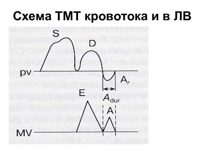 Схема ТМТ кровотока и в ЛВ