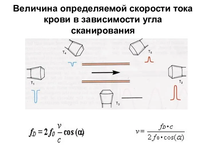 Величина определяемой скорости тока крови в зависимости угла сканирования