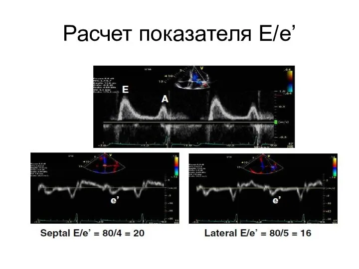 Расчет показателя Е/e’