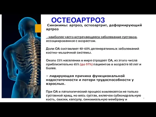 ОСТЕОАРТРОЗ Синонимы: артроз, остеоартрит, деформирующий артроз - наиболее часто встречающееся заболевание