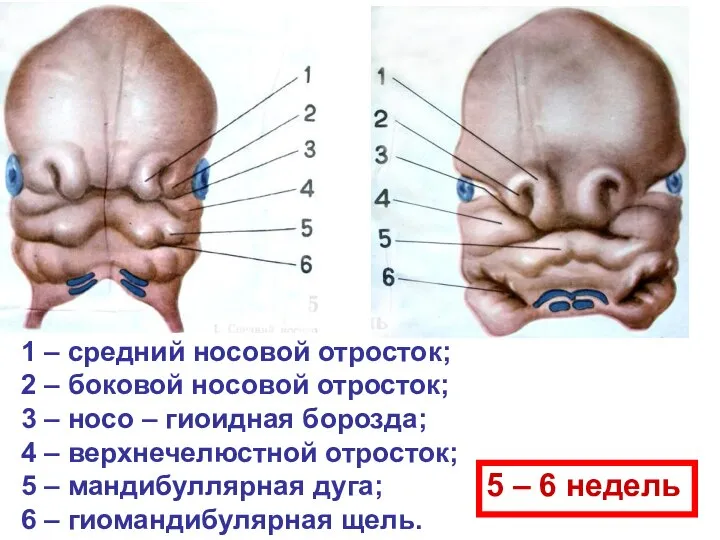 1 – средний носовой отросток; 2 – боковой носовой отросток; 3